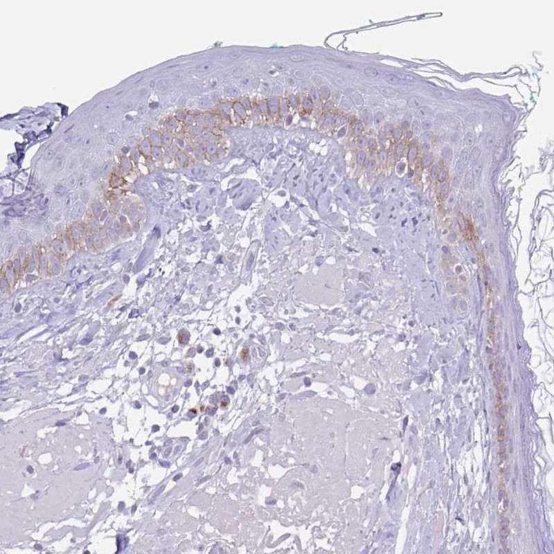 1652661431291869.jpg PA5-62710-COL17A1-Polyclonal-Antibody-IHC-2-20190131155521.jpg